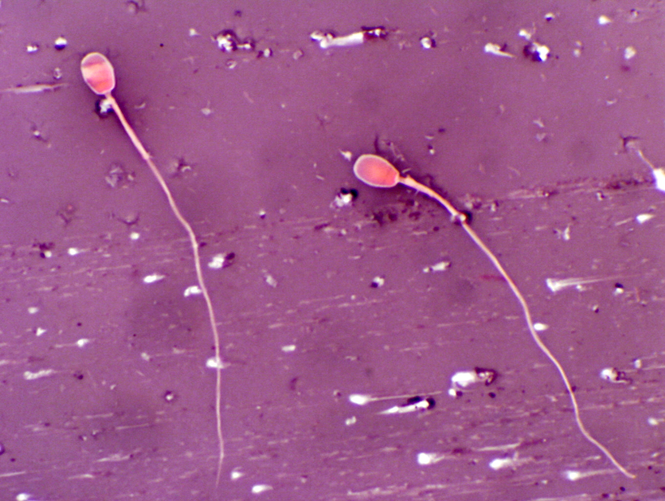 Sperm cell tissues Multiple girl scissor bondage thumbnails